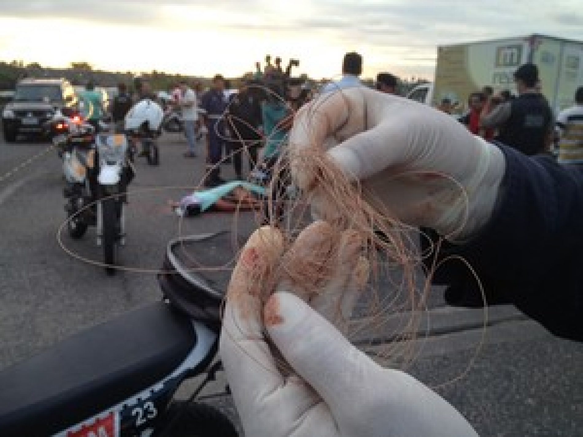 Motociclista dá entrada em estado grave na Santa Casa após ter pescoço cortado por linha de cerol
