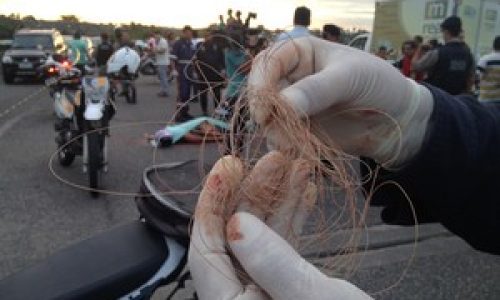 Motociclista dá entrada em estado grave na Santa Casa após ter pescoço cortado por linha de cerol