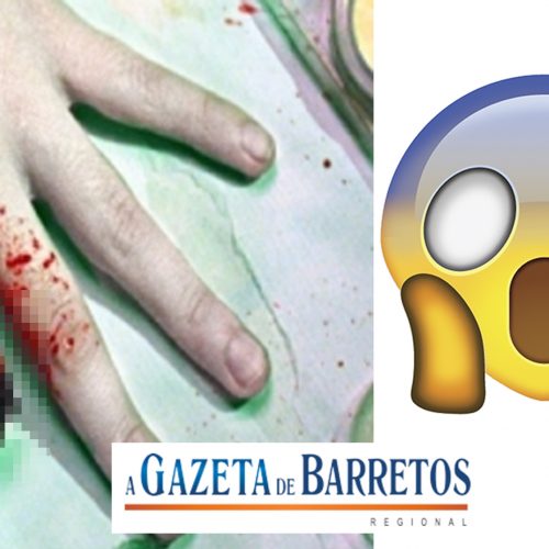 ARARAQUARA: marido arranca parte do dedo da mulher no dente!