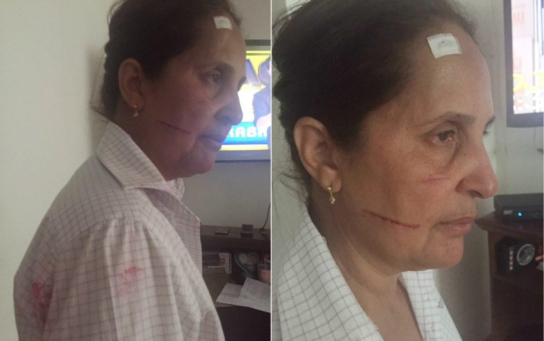 SERRA AZUL: Vereadora é agredida por mãe de funcionária pública investigada por ocupar cargo irregular
