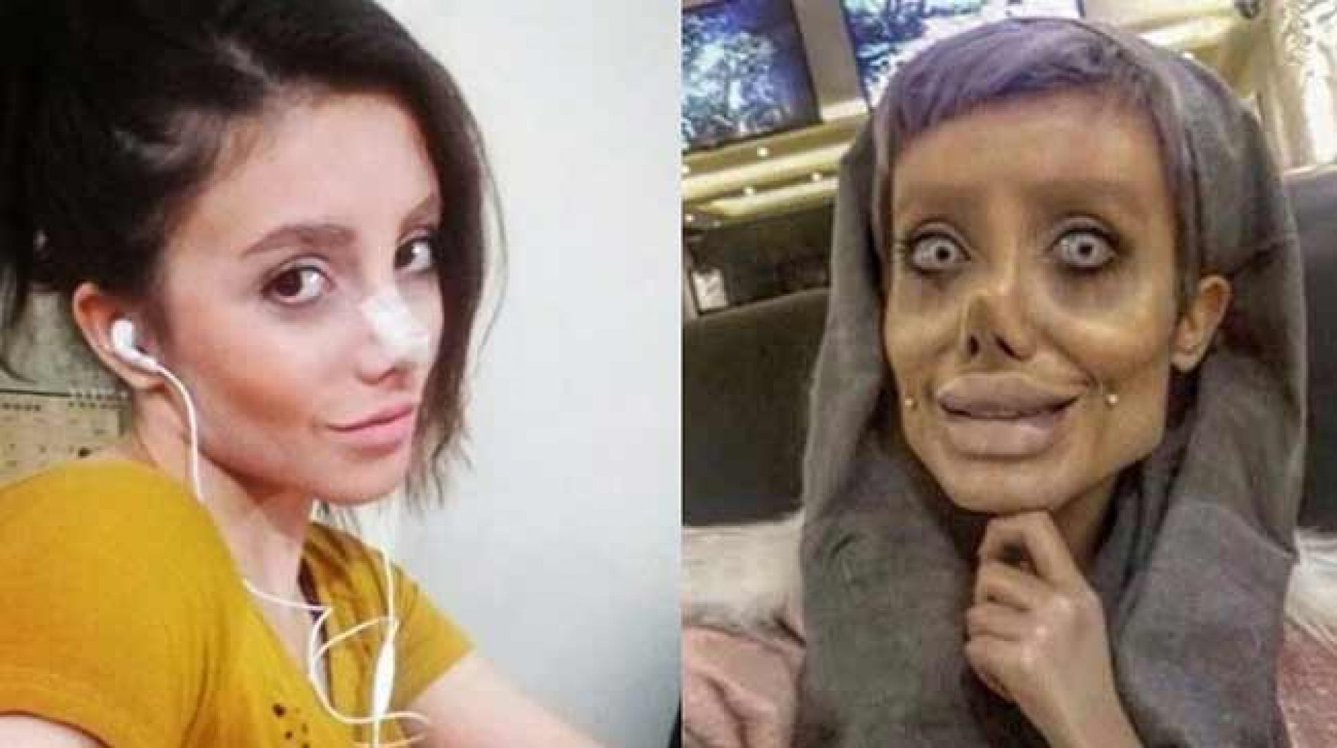 Falso:  Moça de 29 anos não fez 50 cirurgias para parecer Angelina Jolie