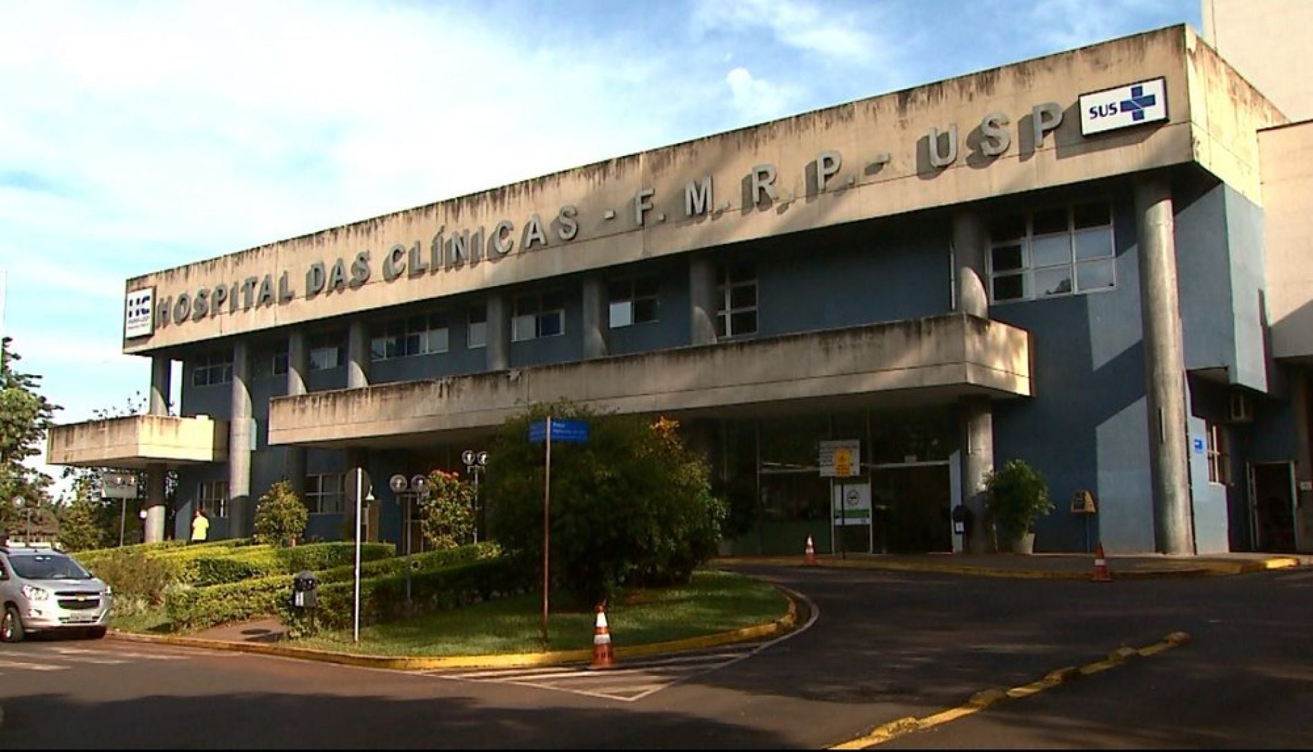 REGIÃO: Bebês siamesas unidas pela cabeça serão separadas no Hospital das Clínicas da USP em Ribeirão Preto
