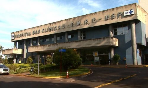REGIÃO: Bebês siamesas unidas pela cabeça serão separadas no Hospital das Clínicas da USP em Ribeirão Preto