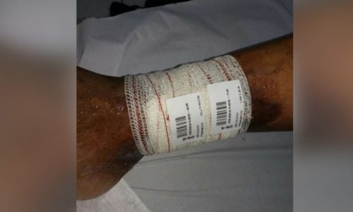 REGIÃO: Paciente tem curativo feito com adesivo de impressora