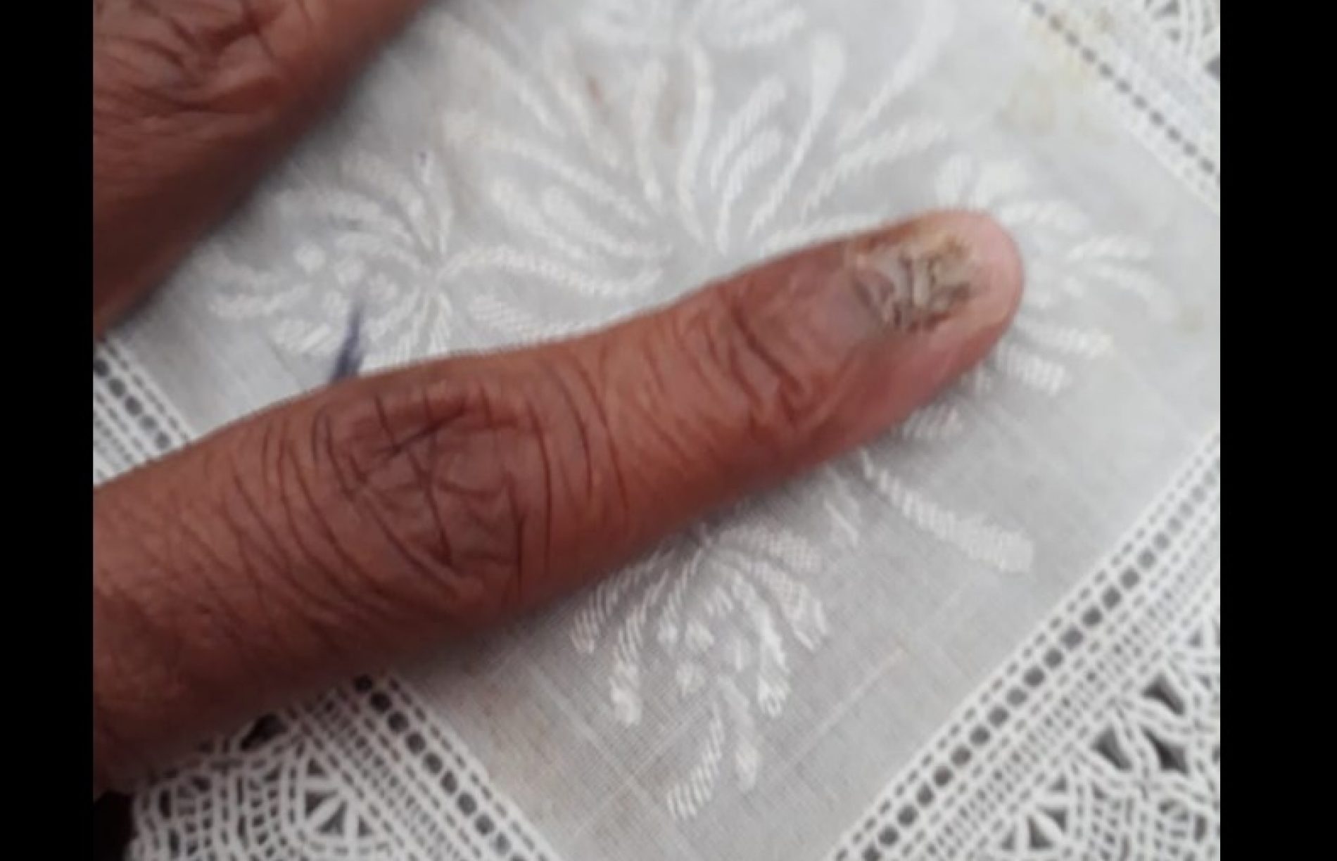 REGIÃO: Mulher perde duas unhas ao tentar evitar roubo de veiculo