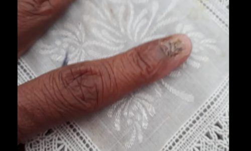 REGIÃO: Mulher perde duas unhas ao tentar evitar roubo de veiculo