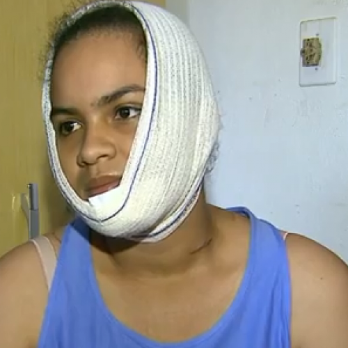 BARRETOS: Mulher se fere gravemente ao se cortar com linha de cerol