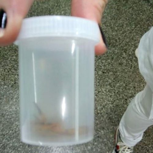 REGIÃO: Jovem é picado por escorpião dentro do pronto-socorro central