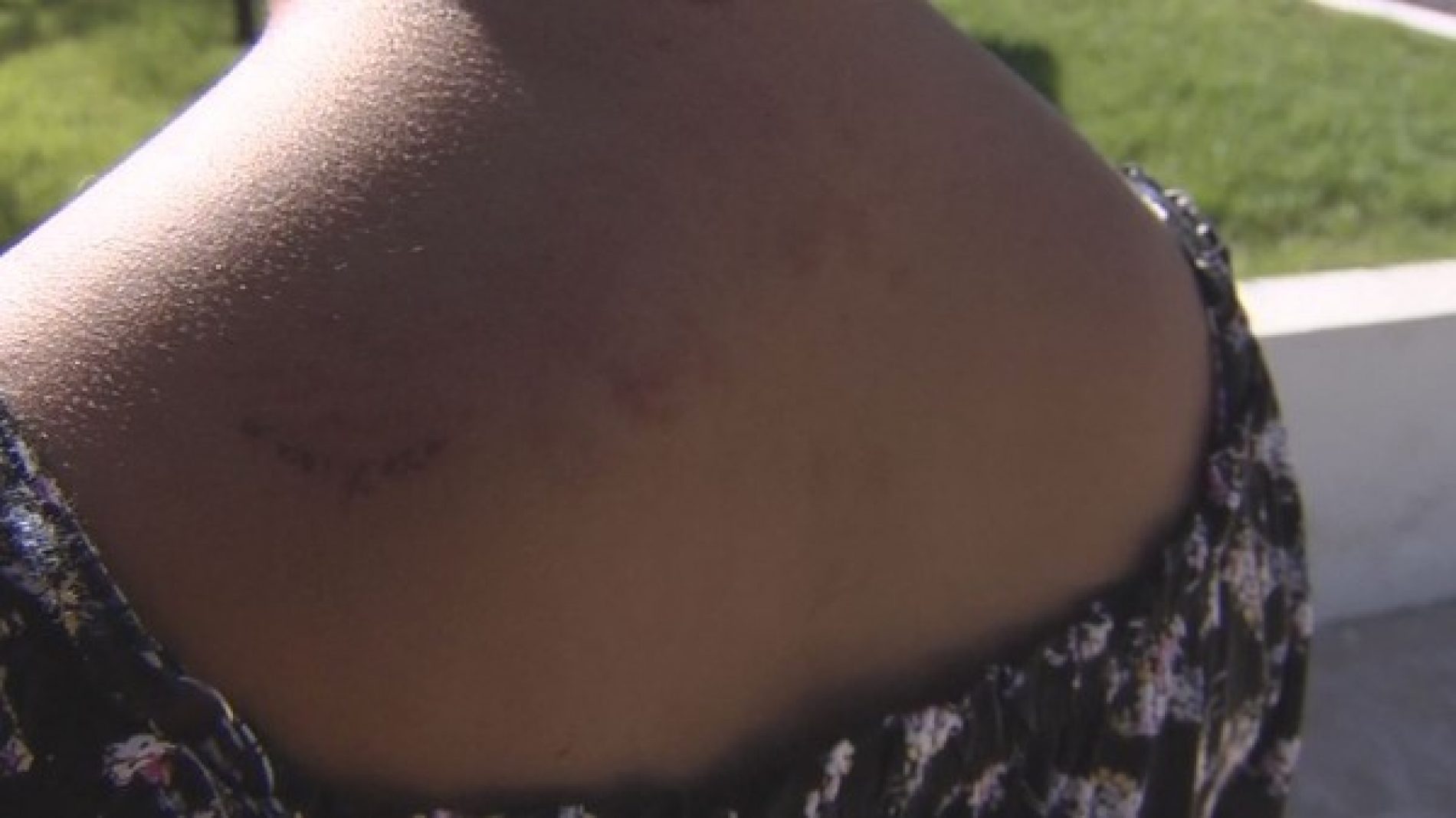 REGIÃO: Mulher é agredida a marretadas pelo companheiro na frente da filha