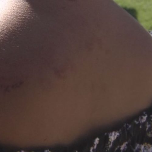 REGIÃO: Mulher é agredida a marretadas pelo companheiro na frente da filha