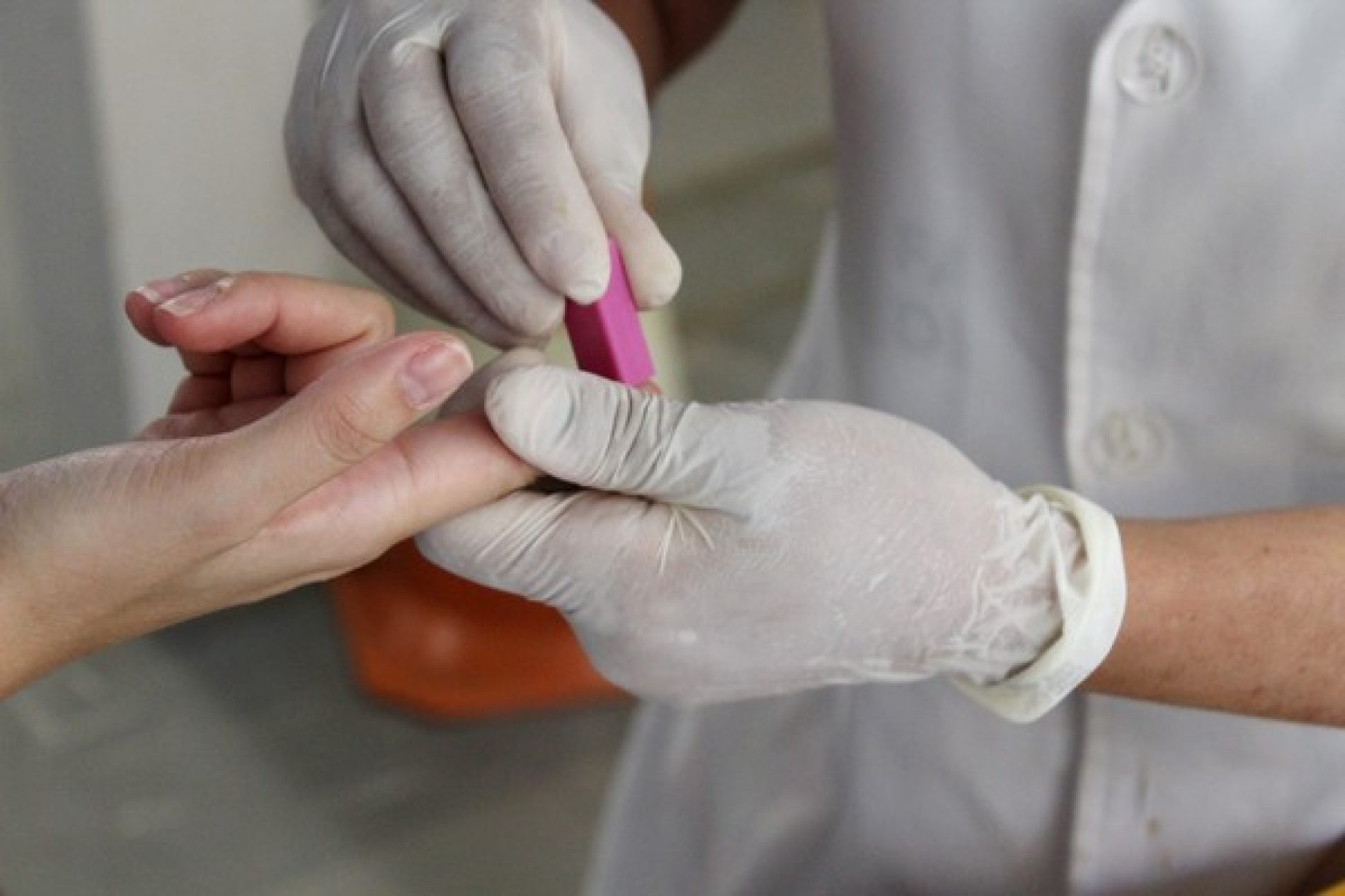 REGIÃO: Equipes realizam teste rápido para diagnóstico de hepatite C