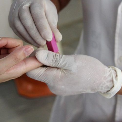 REGIÃO: Equipes realizam teste rápido para diagnóstico de hepatite C