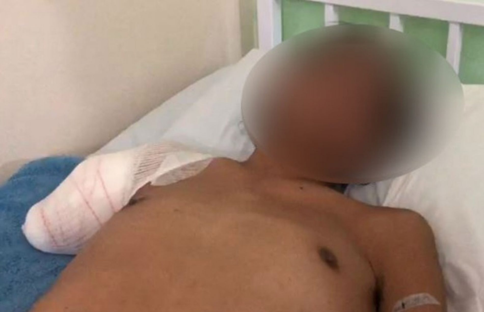 REGIÃO: Justiça absolve agressor de indígena que teve braço amputado