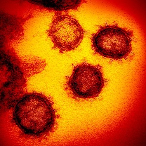 REGIÃO: Prefeitura de Jaboticabal confirma 1ª morte por novo coronavírus