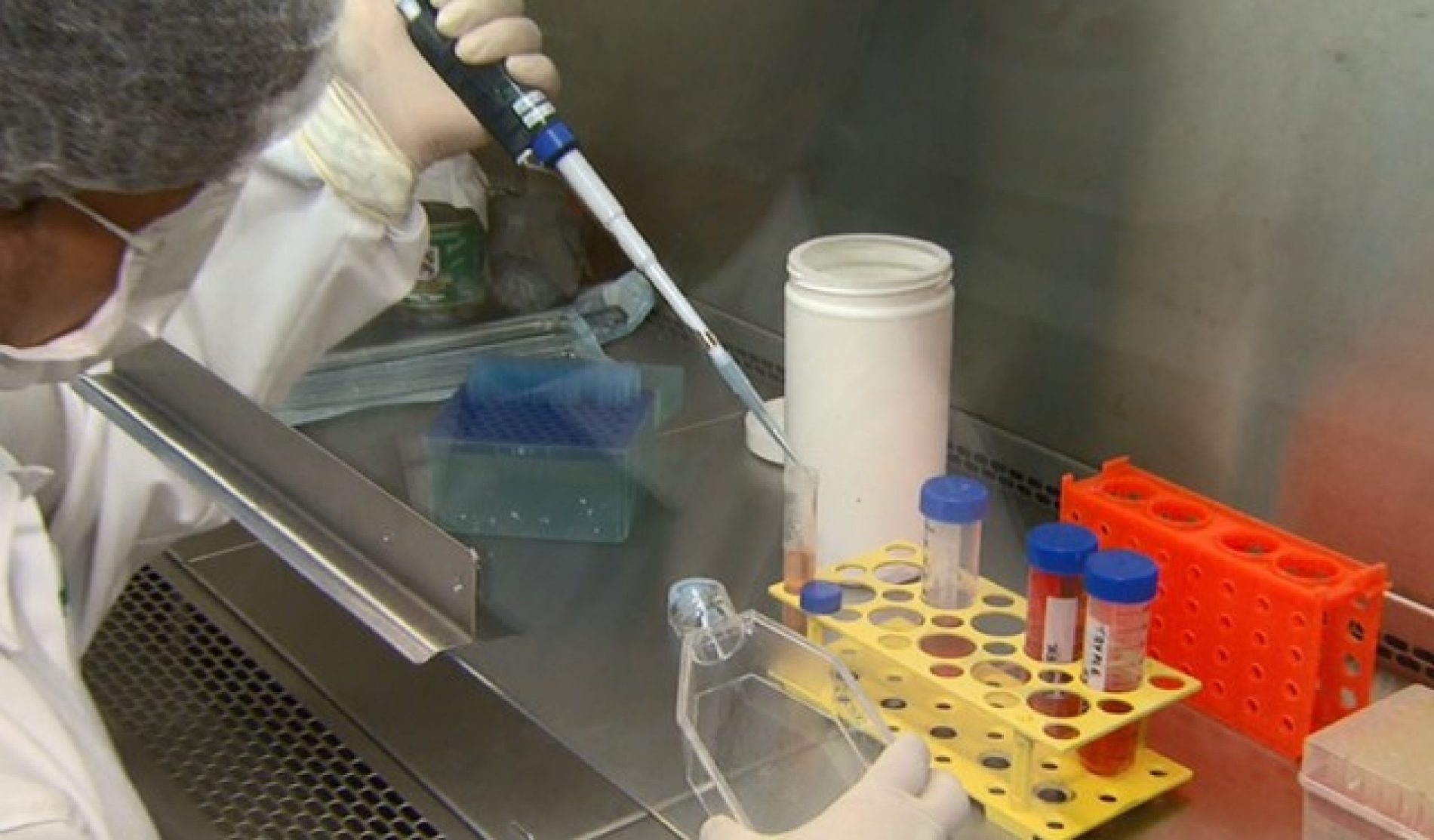 Brasil tem ao menos 23 mil testes de coronavírus à espera do resultado