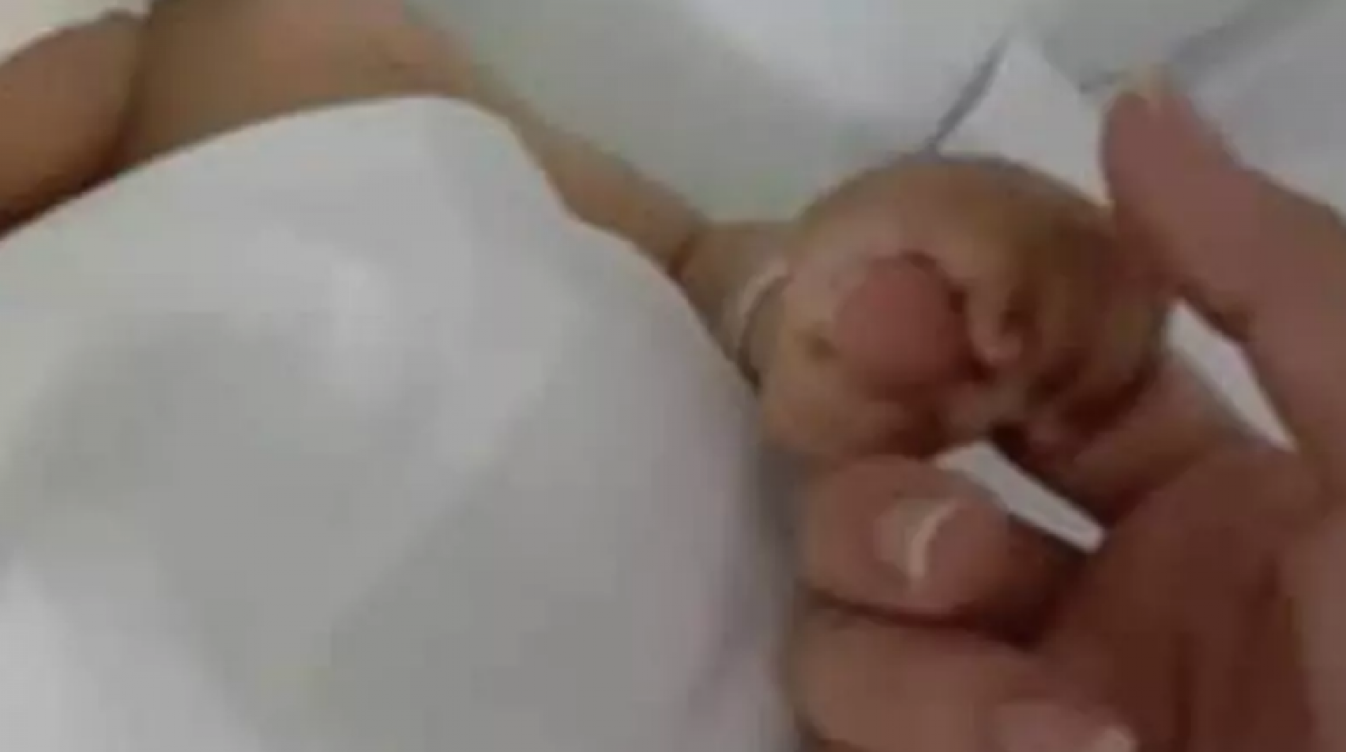 REGIÃO: Bebê tem parada cardíaca após receber medicamento em hospital